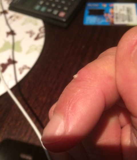 A snapper’s revenge